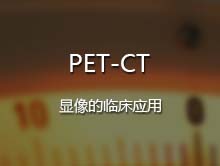 PET-CT显像的临床应用